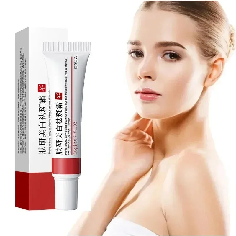 1/3/5pcs Whitening Freckle Cream Niacinamide Remove Dark Spot Cream Anti Freckle and Aging Cream Fade Pigmentation Melasma Skin